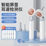 HD Ear Canal Endoscope Personal Care Smart Screen Ear Canal Detector Ear Inspection Instrument DOV0