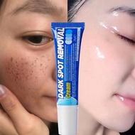 Whitening Freckle Cream 20g Penghilangkan Bintik Gelap Anti Bintik Niacinamide Memudar Pigmentasi Me
