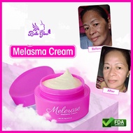Melasma Pekas Remover Cream 12g Effective Pekas Remover Freckles Whitening by Belle Glow