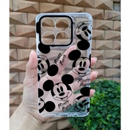 Casing Hp ZTE BLADE A55 - ZTE BLADE A35 Terbaru - Softcase Silikon Hp ZTE BLADE A55 Terbaru