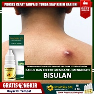 Obat Bisulan Pantat Bisulan Gatal Bisulan Bisul Buat Anak Bisul Bernanah Bisul Di Wajah Bisul Di Kem