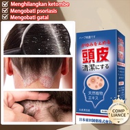 Obat Ketombe Penghilang Ketombe Dermatitis Seboroik Semprotan Psoriasis Kulit Kepala Ketombe Berkera