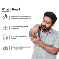 Nigrifix Cream Brighten Skin Tone Remove Black Hands Feet Joints Knee Body Cream PO7F