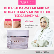 Alamin Post Acne Cream Azza Niacin penghilang Bekas Jerawat Merah Noda Hitam