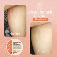 Stretch Mark Remover Cream - Clarity Essentials Stretch Mark Cream Pregnancy Cream