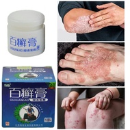 Baixuangao Itching Relief Cream Itching Ointment Eczema Ointment Skin Ointment Psoriasis Cream Most Powerful Scalp Psoriasis Hand Tinea Feet Odor Versioncolor Inhibits