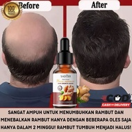 Serum Penumbuh Rambut Botak dan Rontok