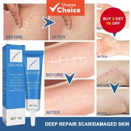 Recovery Scar Cream Fast Removal Skin Scars Treat Surgery Scars Stretch Marks Acne Pox Prints Burn R