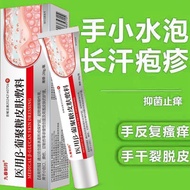 氧森推荐 汗疱疹手上起小水泡手痒脱皮止痒皮肤瘙痒感染真抑乳膏 OxySen recommends this cream for treating herpes simplex, small blist