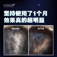 EcoHair Hair Tonic Shampoo Growth Aloe Vera Anti Hair Loss Refreshes Scalp
