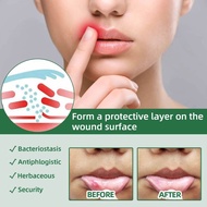 ✱ ⊙ Canker Mouth Sore Solution Mouth Ulcer Treatment Spray gamot sa singaw