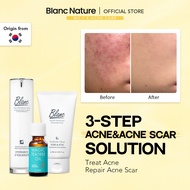 [ Blanc Nature Official ] 3 Step Acne&Acne Scar Solution ( Instant Acne Spot Remover + Acne Pimple F