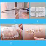 【Innovative】 1/10pcs Outdoor Portable Zipper Wound Closure Patch Wound Fast Suture Zipper Band-Aid S