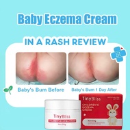TinyBliss 50g Baby Diaper Cream Rash Cream Eczema Cream Baby Anti-Itch Cream Antiseptic