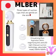 MLBER Pore Aspirator Magnifying Lens Built-in LED Light Pore Cleaning Pore Care Keratin Removal Powe