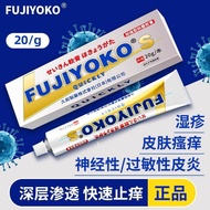 [Skin Itching Anti-Itching King] Authentic Anti-Itching Cream Powerful Skin Itching Skin Sterilizati