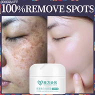 ❤️SG Stock❤️ Freckles removal cream Dark spot remover Pigmentation black spot remover Brightening moisturizing cream 祛斑霜