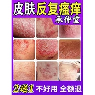 Specialized Inflammation Antibacterial Ointment for External Use, Itchy Skin, Ringworm, Tinea Versic
