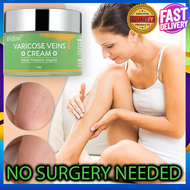 100% original authentic 50g SEFUDUN Varicose Vein Cream effective treatment of varicose veins Varico