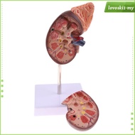 [LovoskibcMY] Human Kidney Models, Lifesize Kidney with Adrenal Gland Model, 2 Parts Removable, Medi