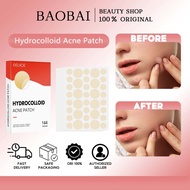 EELHOE Acne Patch 144pcs/ Patch Spot (144patches)