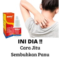 Obat Kurap Paling Ampuh Permanen Panu Paling Ampuh Kalpanak Resida Cair Obat Jamur Kulit Penghilang