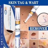 Wart Corn Remover Pen Clean Genital Warts Moles Papillomas T