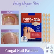 【M'SIA SHIP OUT 24HRS】Nail Antifungal Care Patch 21pcs Nail Repair Patches Fungal Nail Treatment Res
