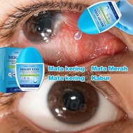 Hot Sale Eye Drop Katarak Mata Ubat Obat Mata Katarak Dan Rabun Ubat Titis Mata Dry Eyes Drops Painf