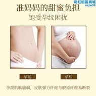 妊娠紋油橄欖油孕婦去肥胖紋修復霜消除預防產後專用生長紋護膚