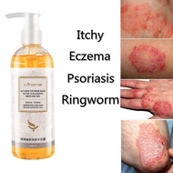 sabun gatal kulit eczema eczema body wash eczema treatment Gatal Kulit treatment eczema psoriasis Ri