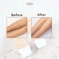 CIARA CHAMOMILE CALMING CREAM OINTMENT FOR BURN SCARS, REMOVES SCARS BY CIARA