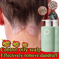 Syampoo kelemumur dan gatal kepala Psoriasis scalp Itchy scalp Anti dandruff shampoo Shampoo Oil Con