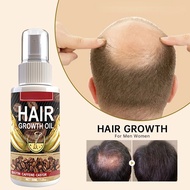 【CW】 Hair Loss Prevention Growth Spray Alopecia Treatment Fast Growing Dry Damaged