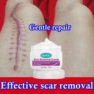 Acne Scar Removal Cream Repairing Body Face Scar Gel Lighten Burns Skin Stretch Marks Repair Facial
