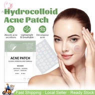🇸🇬 Acne Pimple Patch Sticker Remover Acnes Nose Face Skin Care Acne Sticker Patches Invisible Acne M