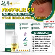 Medicine for Lumps in the Neck - Lymph Nodes - Goiter - Lipoma Propolis SM (Pay on Delivery)