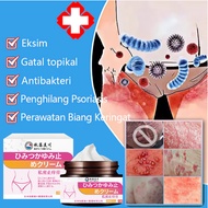 Private antibacterial cream-Vaginal itchy cream-Private part itching cream 30g Fast itch relief and 