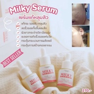 Direct Acne Scar Treatment Serum Acne Scar Removal