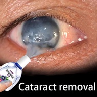 eye drops 12ml Eye drops for dry eyes Eye Drops myopia astigmatism improvement Refreshing/ Soothing/