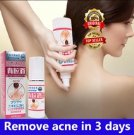 Acne Back Spray Body Mist Spray 60ml | Back Acne Scar & Dark Mark |Parut & Kesan Jerawat Belakang Ba