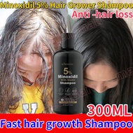 Minoxidil Hair Growth Minoxidil Shampoo 300ml Hair Loss Shampoo Hair Growth Shampoo Anti Hair Fall P