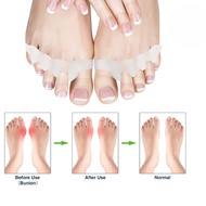 (One Pair) Silicone Toe Supporter Bunions Forefoot Spread Overbend Deformation Toe Pain Relief