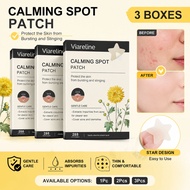 Conceal Blemishes Star Acne Patch Hydrocolloid Colorful Invisible Stickers 200/288PCS Pelekat Jerawa