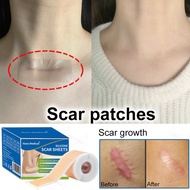 Silicone scar tape Silicone scar sheet Scar patch 4*50cm 1 roll Invisible scars Smooth skin Silicone