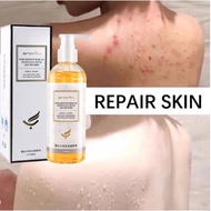 Anti-Mite Shower Gel Amino Acid Shower Gel Antibacterial Mite Removal Personal Care Can Inhibit Mite
