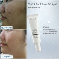 Acne REMOVER IN THE DAY EFFECTIVE SOLUTION BSKIN Anti Acne CREAM 3C Spot Treatment CREAM NATURAL ORG