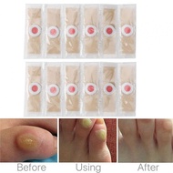 Trusted Plantar Wart Thorn Plaster Perfect Solution for Corn and Callus Removal