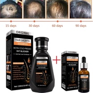 【BF】 Hair Growth Essential Biotin Cold-Pressed Dht Blocker And Hair Growth Shampoo Anti-Hair Loss Co