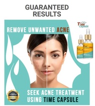 Buy 1 Take 1 Original Belo Time Capsule Advance Scar Treatment Serum Wrinkle Eraser Pimple Remover A